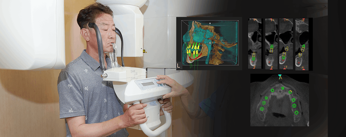 뼈 이식 임플란트 신중하게 결정해야 합니다.