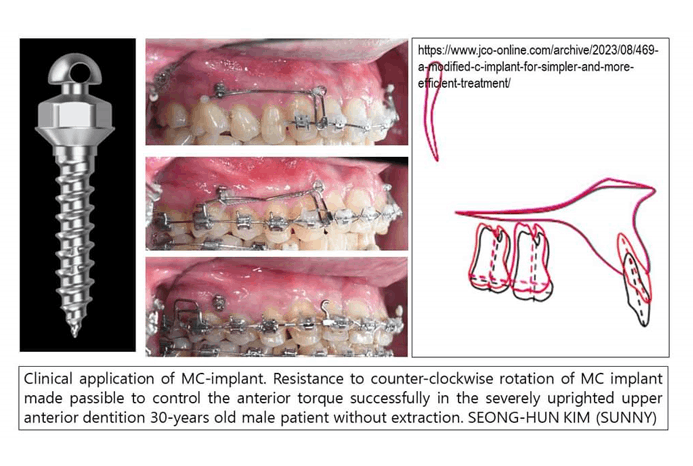 05. 스크류교정장치