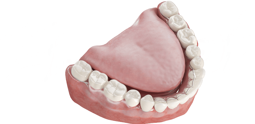 치아미백 이미지