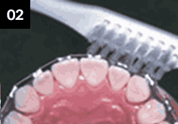 앞니를 닦는 방법