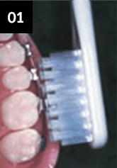 어금니를 닦는 방법