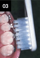 어금니를 닦는 방법