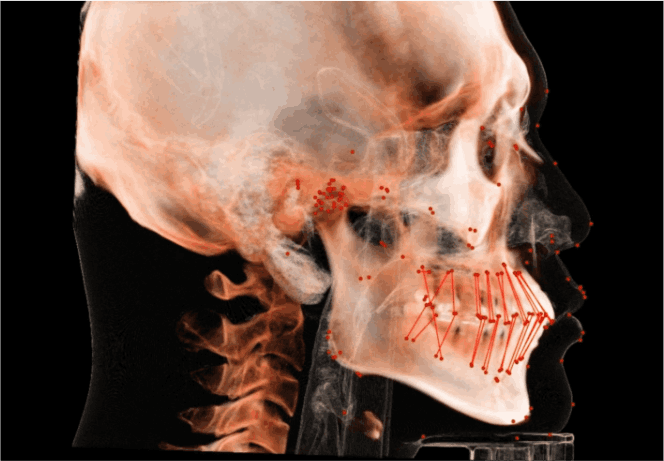 ON3D AI 정밀교정진단