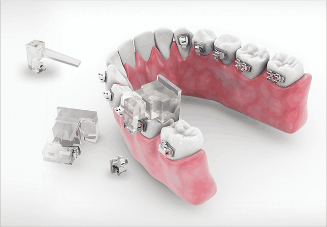 오라픽스 디지털교정
