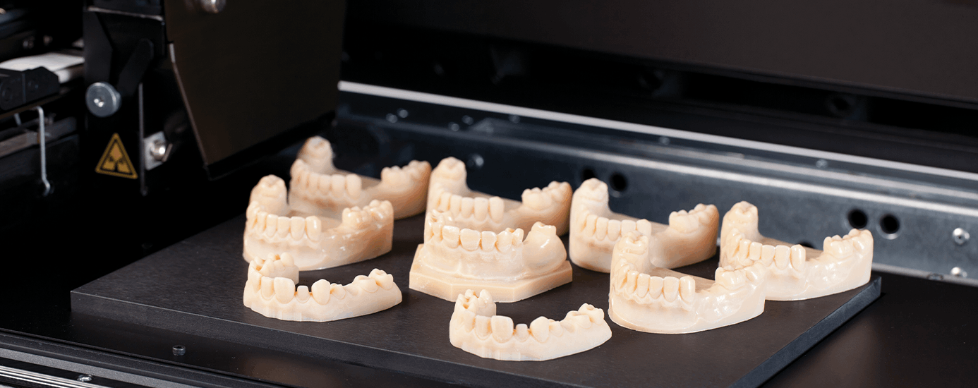 청담뷰치과 시스루 얼라이너 투명교정