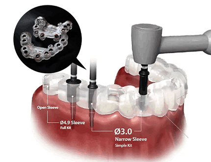 간단하지만 안전하게
