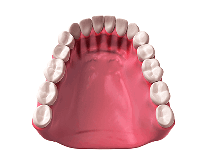 티안나는 보철까지