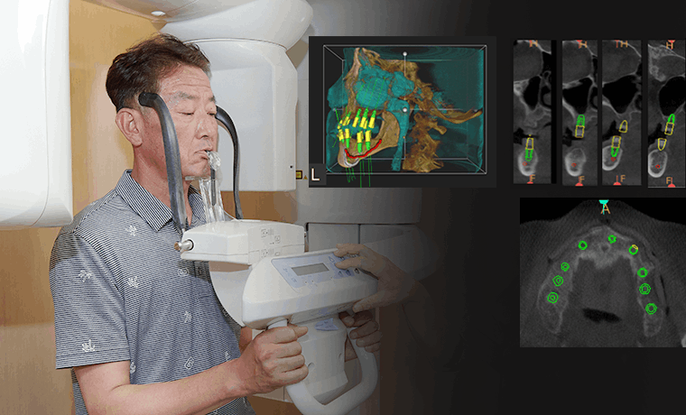 네비게이션 시스템