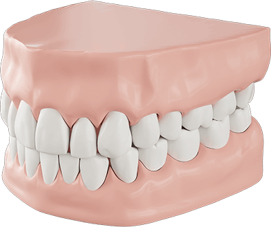 잇몸절제술이 필요한 경우