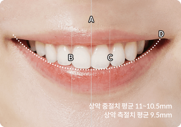 이상적인 치아와 잇몸 선