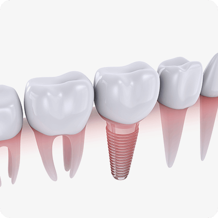 당일 기능, 심미회복