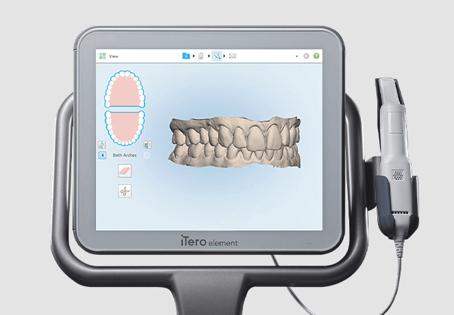 3D디지털 구강스캔