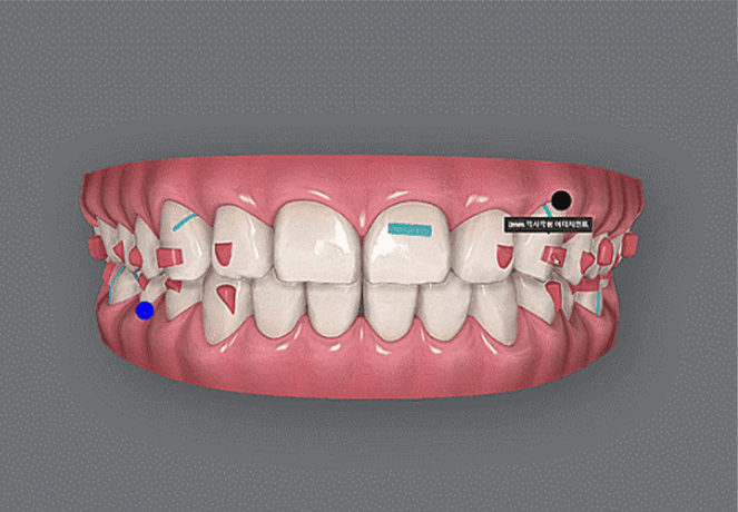 장치제작을 위한 로드맵 설계