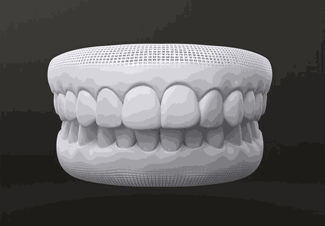 3D프린팅을 통한 장치 맞춤 제작