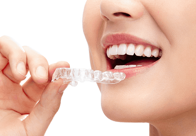 인비절라인 치료