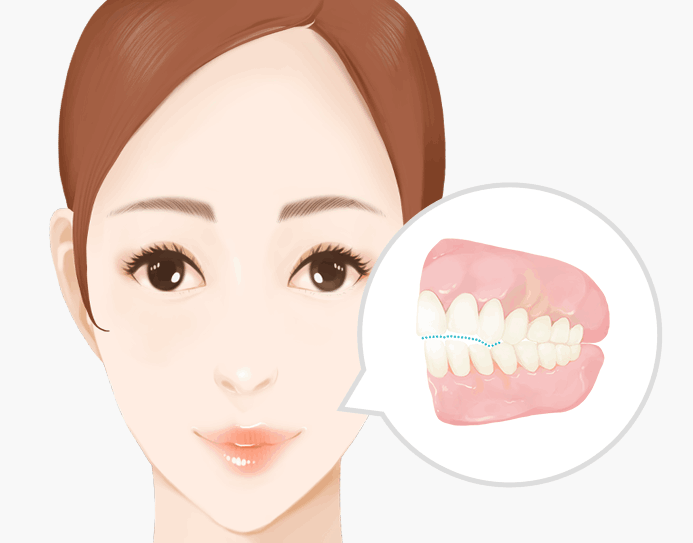 긴 얼굴 치아교정