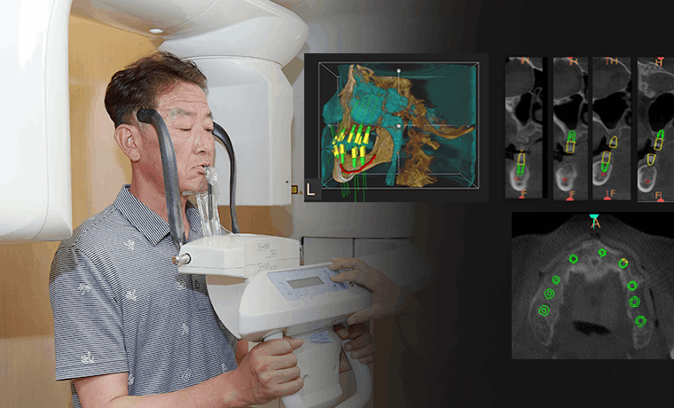 컴퓨터 모의 수술