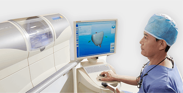 세렉을 이용한 방법