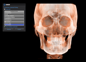상담 및 진단, 치료계획 확정