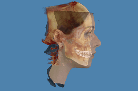RAY를 이용한 진단 준비 및 치아 상태 조사