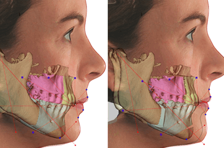 RAY를 이용한 진단 준비 및 치아 상태 조사