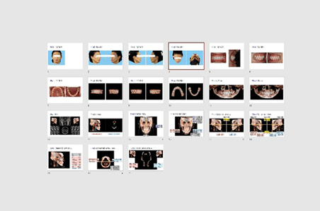 당일 진단 당일 교정 시작