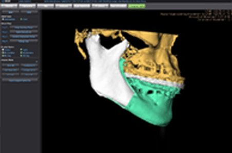 당일 진단 당일 교정 시작