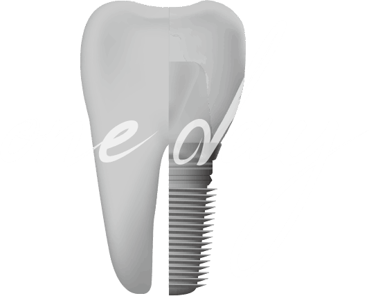 치과공포증 통증완화 임플란트 인트로 이미지