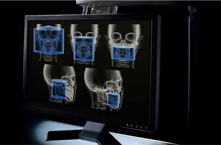 컴퓨터 모의 수술