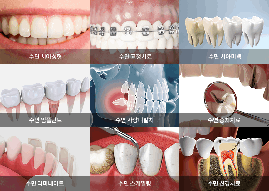 의식하진정법수면치과치료