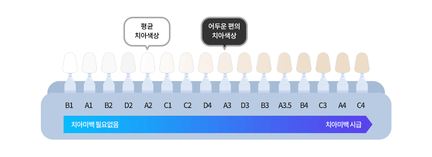치아 밝기 단계