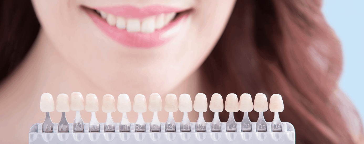 치아미백 기간과 미백 횟수