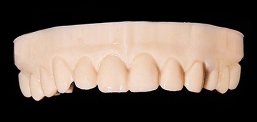 비니쉬 인트로 이미지01