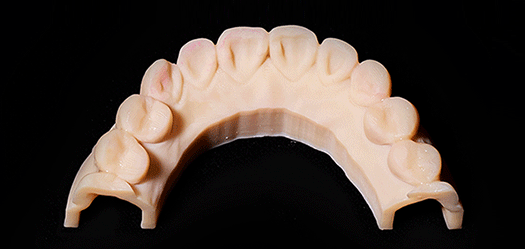 비니쉬 인트로 이미지02
