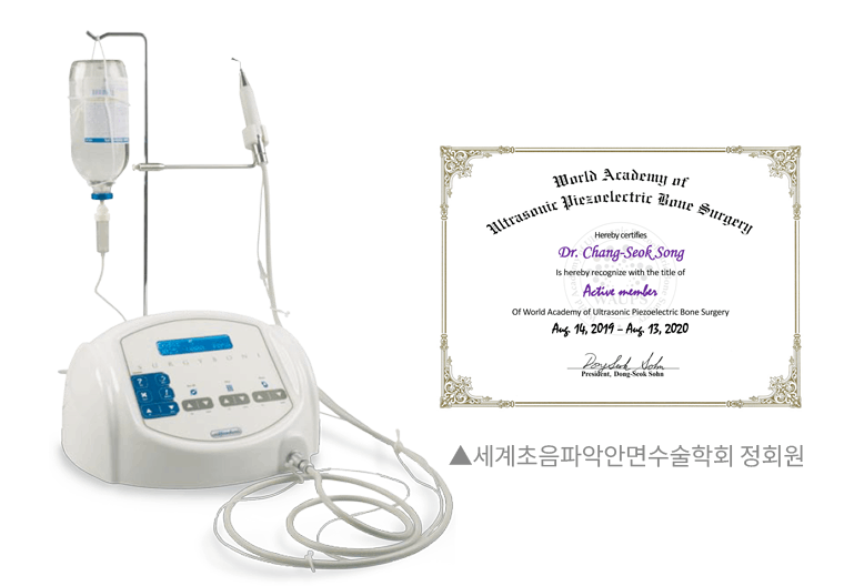 간결한 임플란트