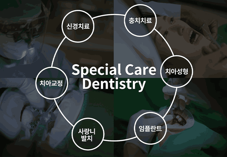 수면통합임플란트